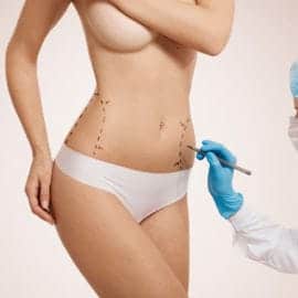 coolsculpting-fat-freezing-cryolipolysis