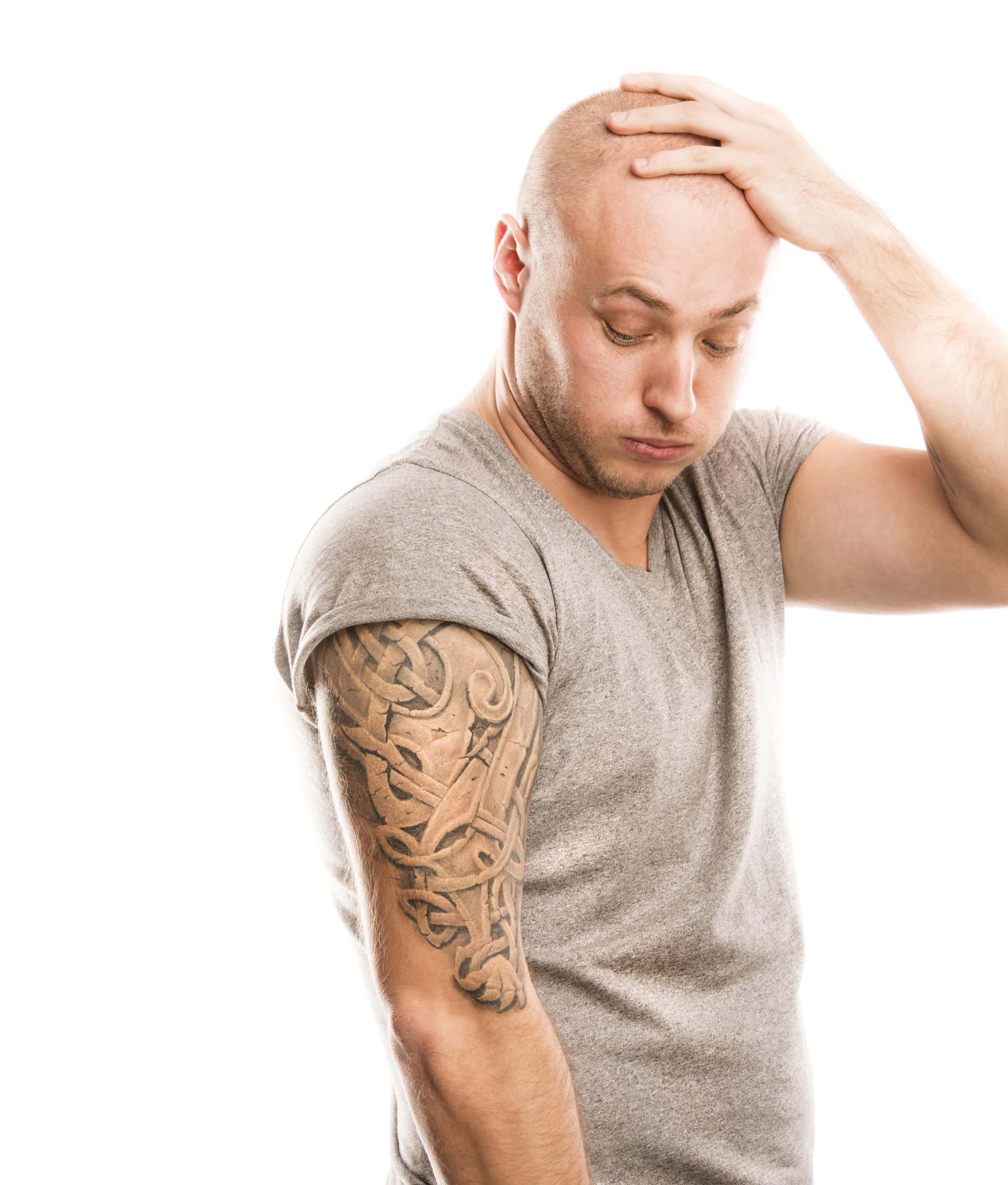 Laser Tattoo Removal