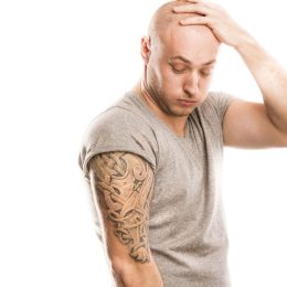 Laser Tattoo Removal