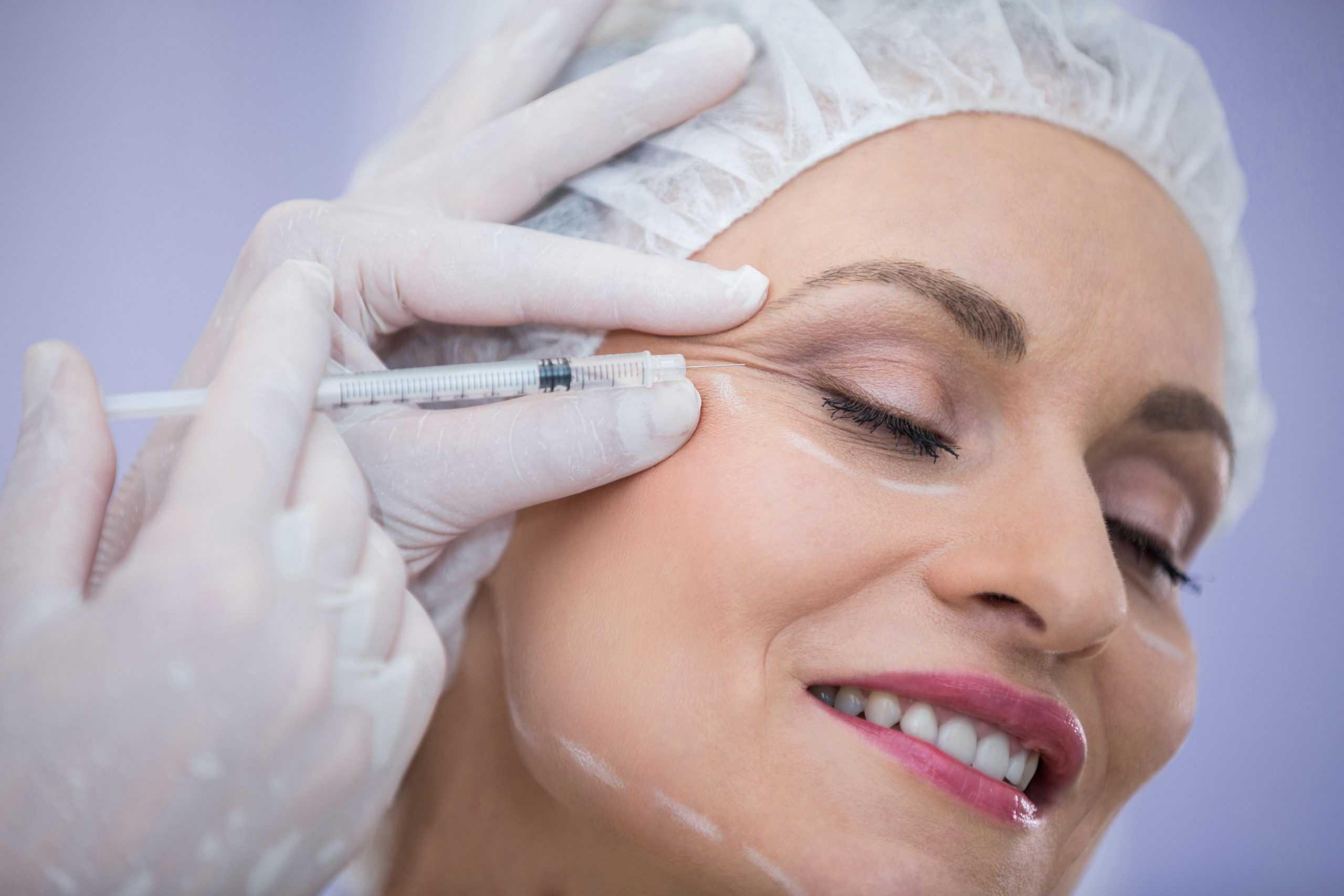 woman with marked face receiving botox injection scaled