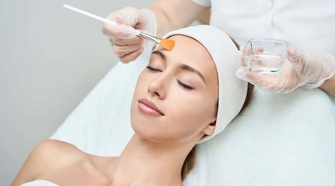 chemical-peel