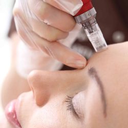 Derma FNS/ Derma Pen/ Microneedling