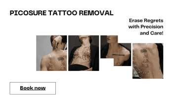 pico tattoo removal