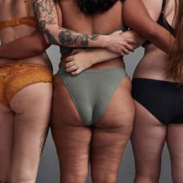 Cellulite Treatment 14