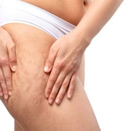 Cellulite Treatment 17