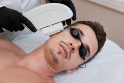 laser-hair-removal
