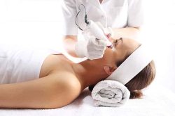 microneedling
