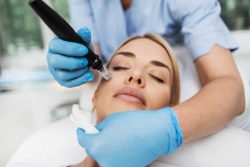 microneedling