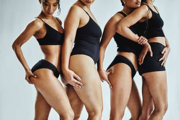 stretch marks removal