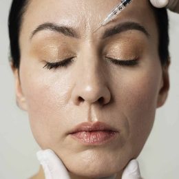 botox 8 scaled
