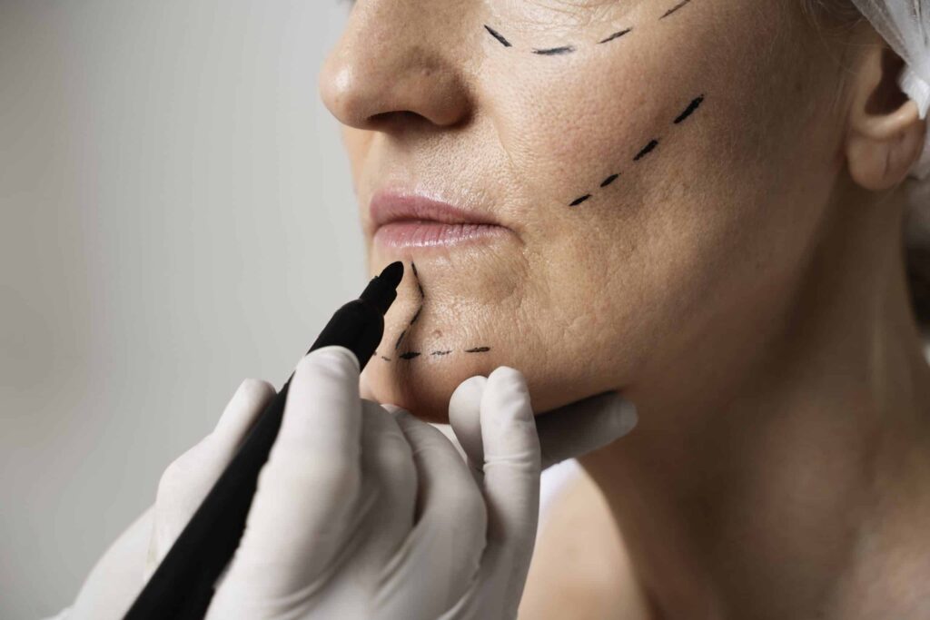 dermal filler course