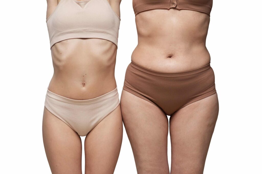HOW TO REDUCE FAT POCKETS NATURALLY 11 fat dissolving injection 2