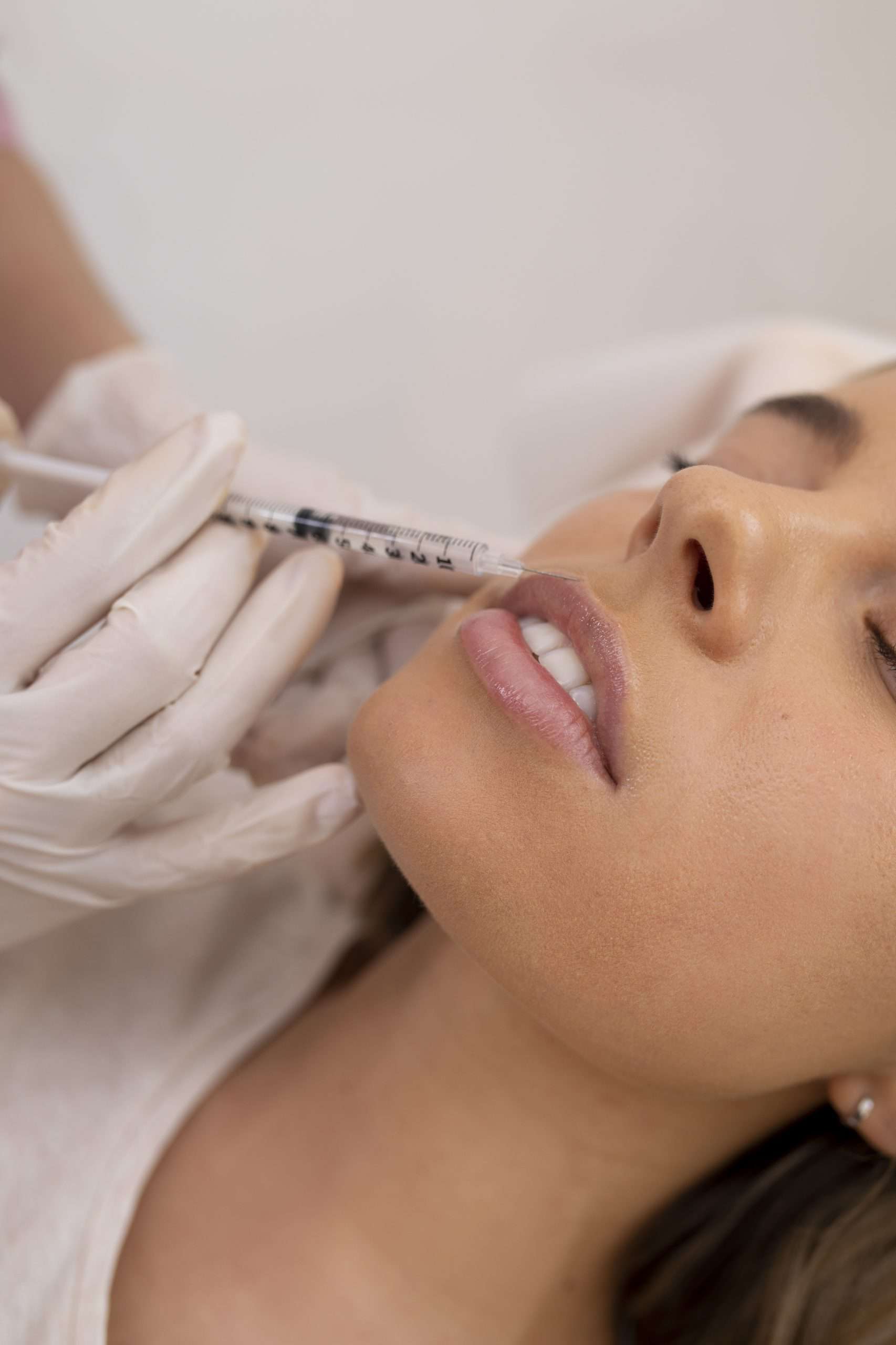 lip fillers 2 scaled