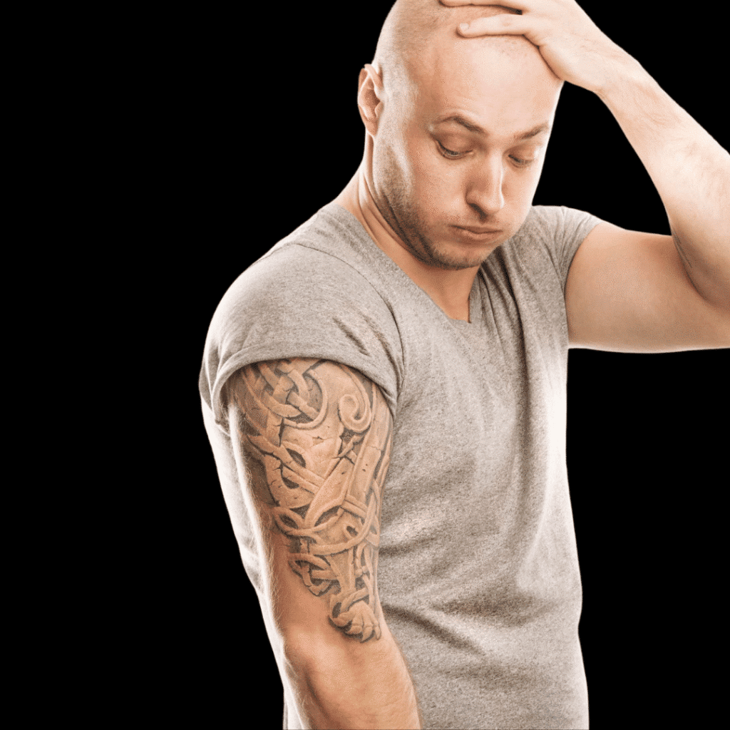 Laser Tattoo Removal