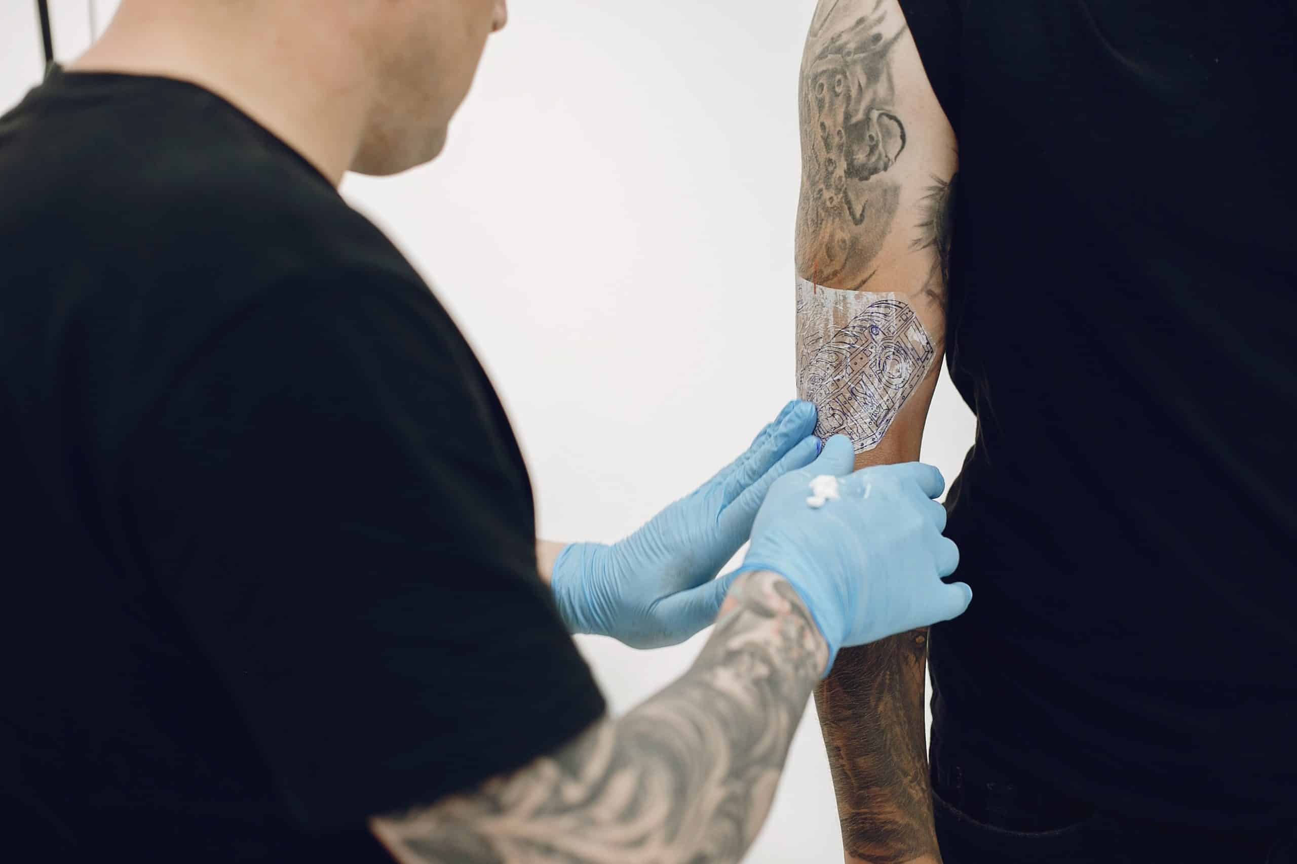 Thinking About Removing a Tattoo_ Here's What You Need to Know About Laser Tattoo Removal