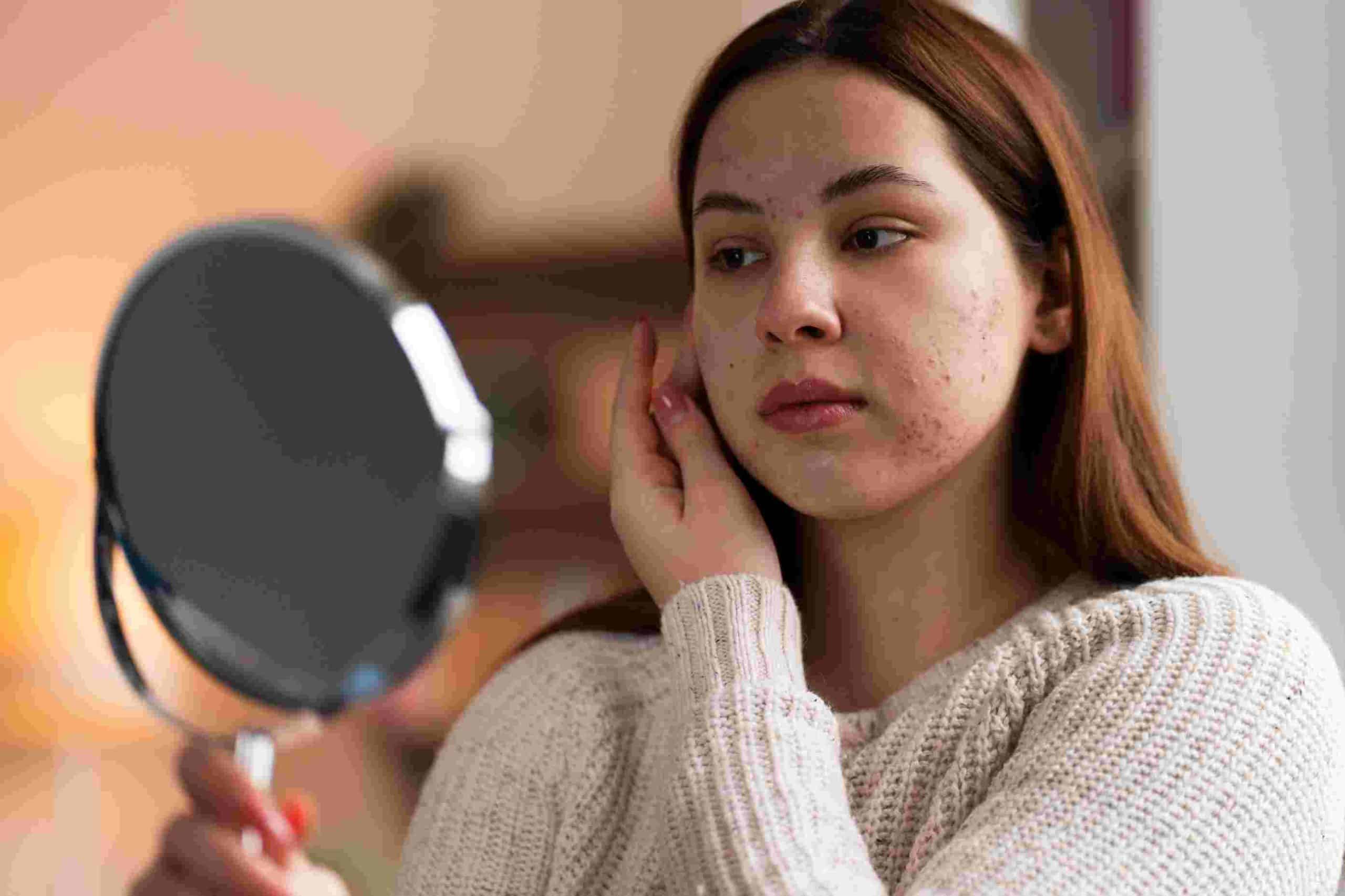 What Fractional CO2 Treatments Can Fix