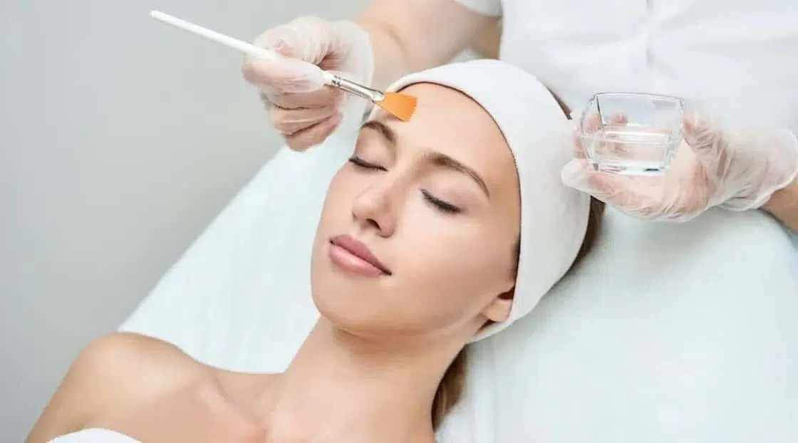 Chemical Peel Treatment London
