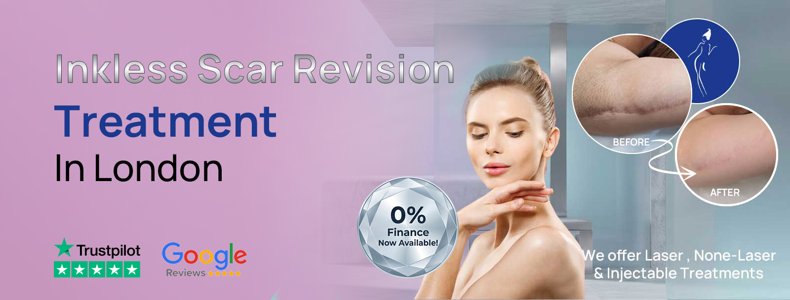 Inkless Scar Revision in London