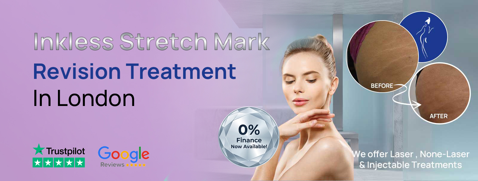 Inkless Stretch Mark Revision Treatment