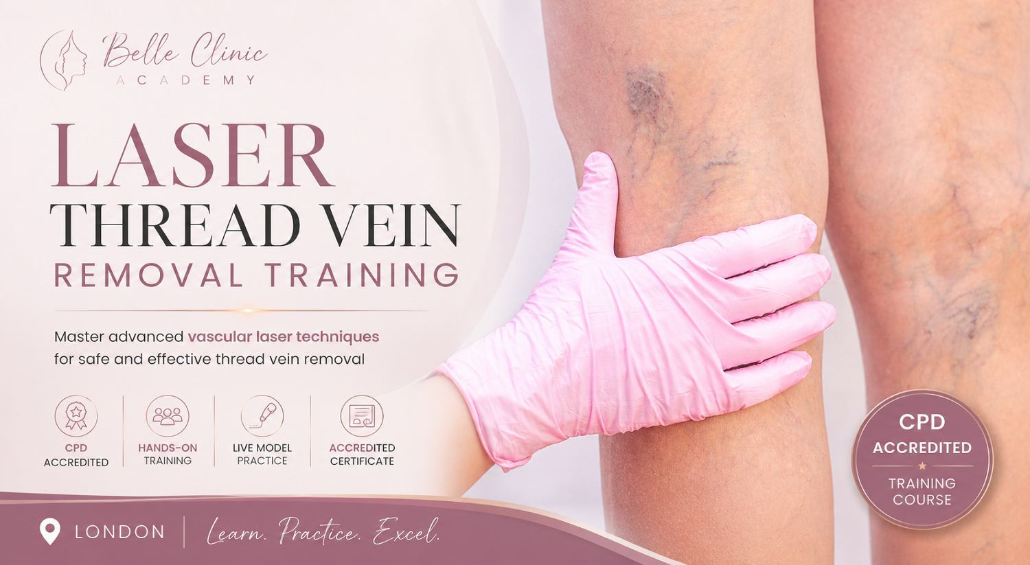 Laser vein removal London