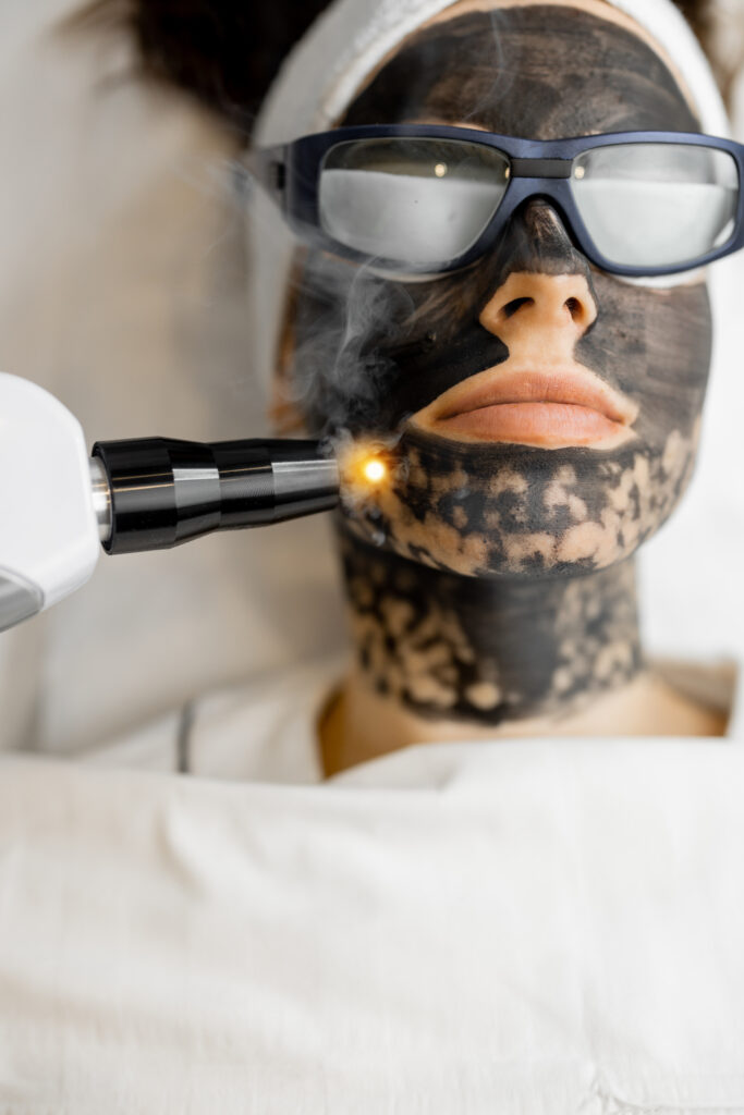Black Carbon Laser Skin Brightening treatment technique taught on the course