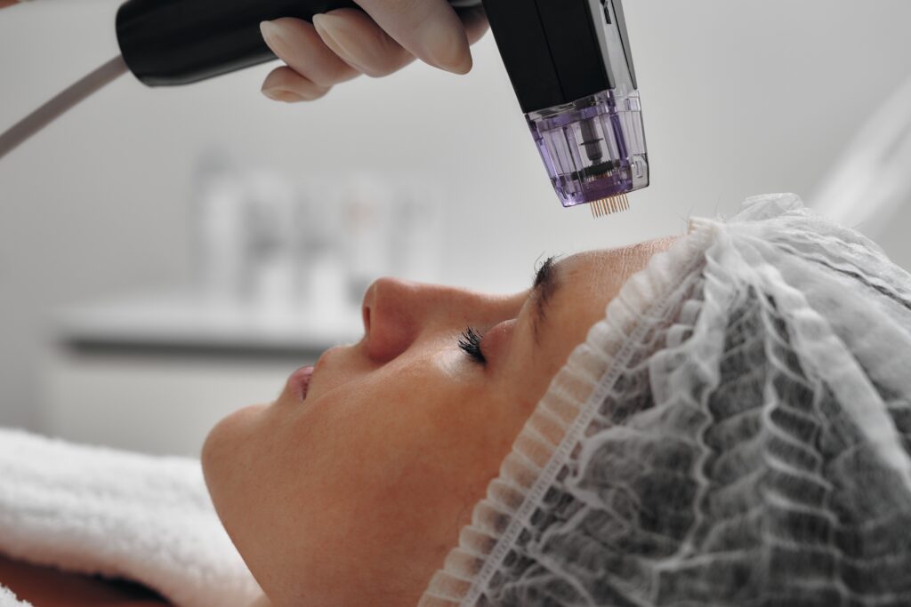 Morpheus8 RF Microneedling treatment technique taught on the course