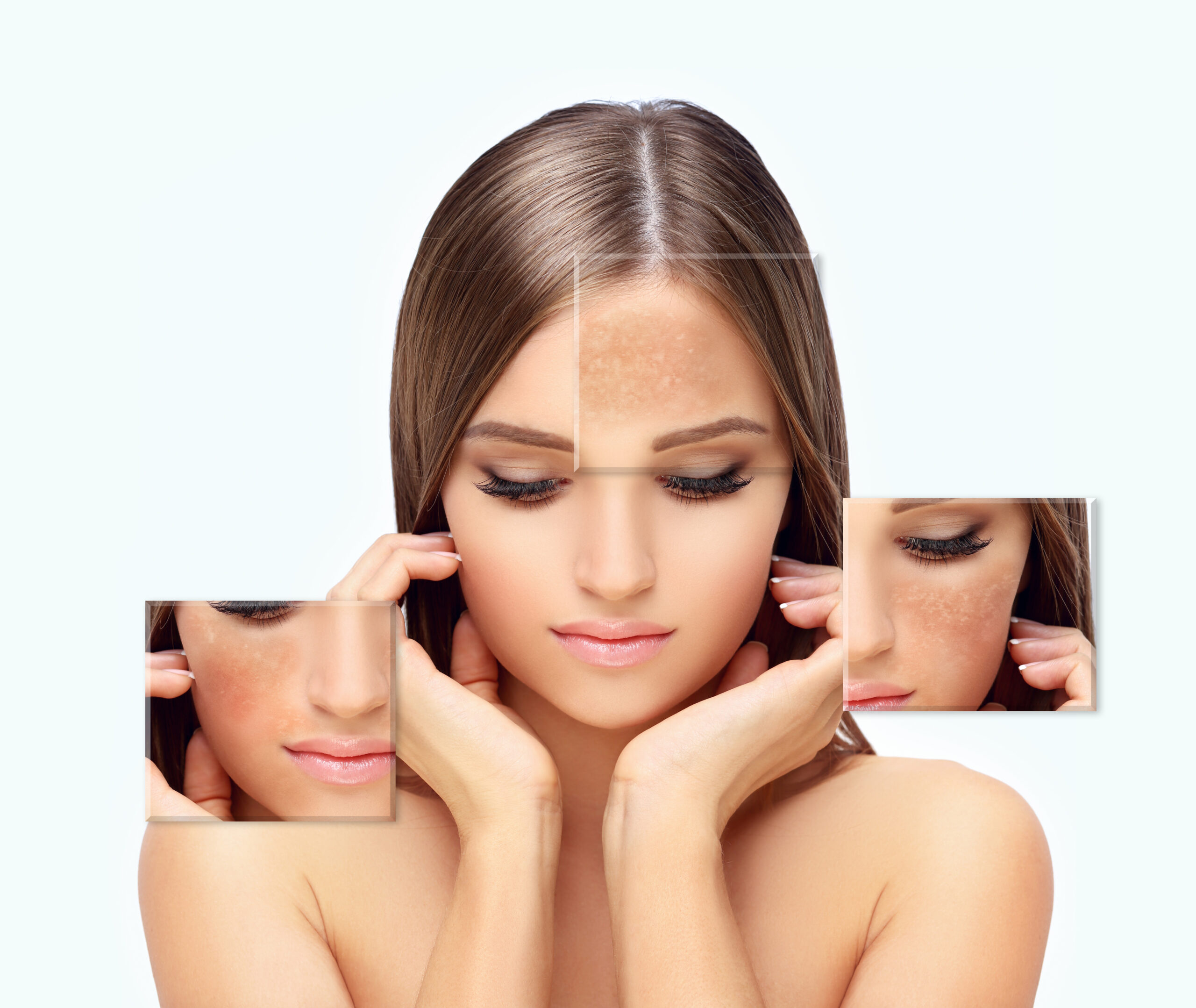Carbon laser facial London for skin rejuvenation