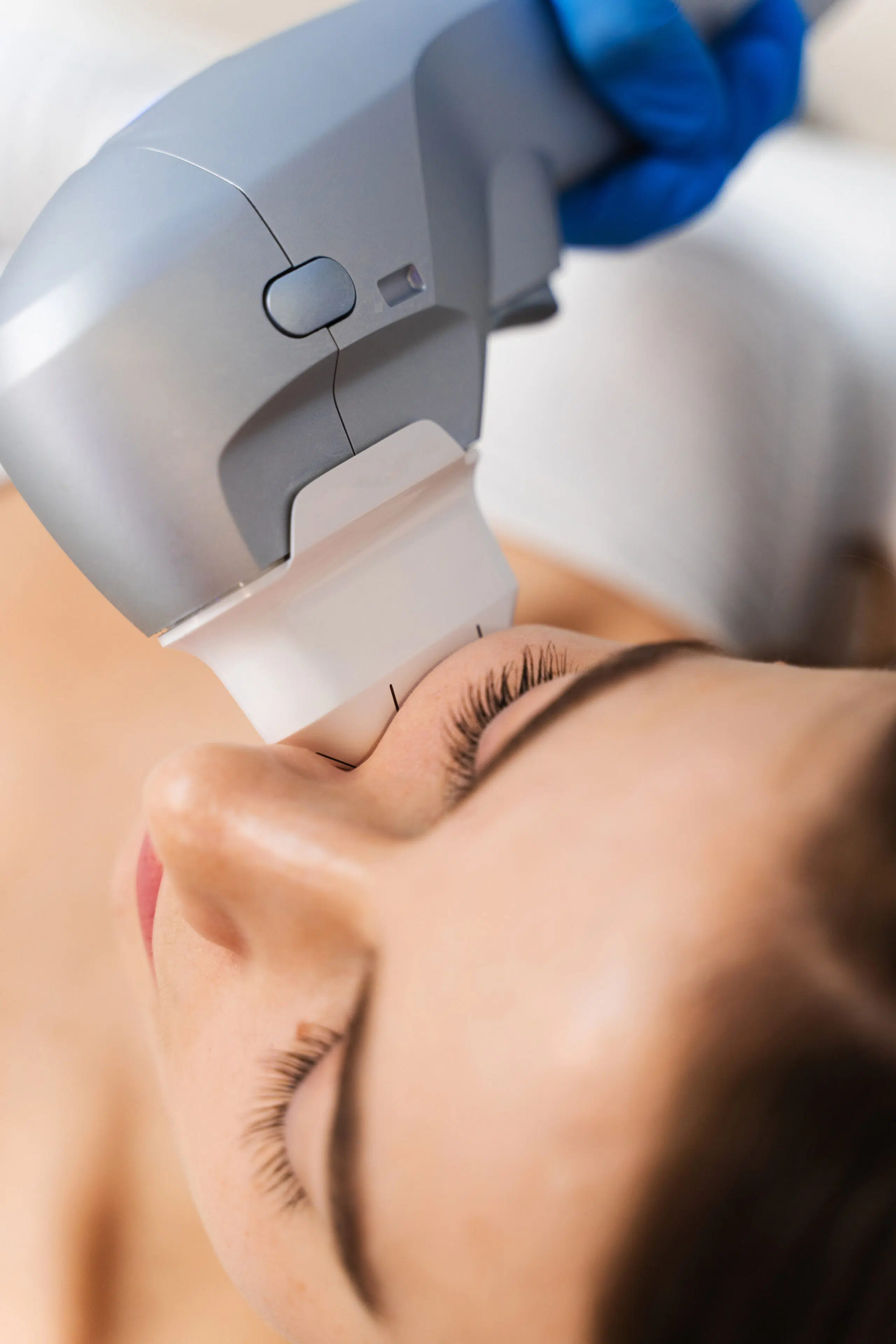 HIFU non-surgical facelift treatment in London at Belle Clinic